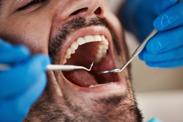 Best Emergency Treatment for Dental Infections or Abscesses in Borger, TX